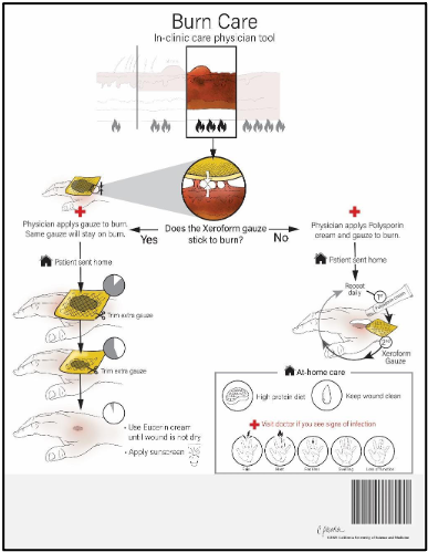 Figure 3: Final iteration of burn education document