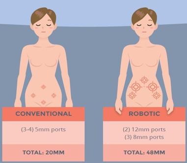 Eric Starble article - https://innovativegyn.com/strategic-incision-placement-laparoscopic-gyn-surgery/